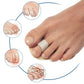 Pedifix - P55 Pedifix Toe Straightener - One Size Fits Most