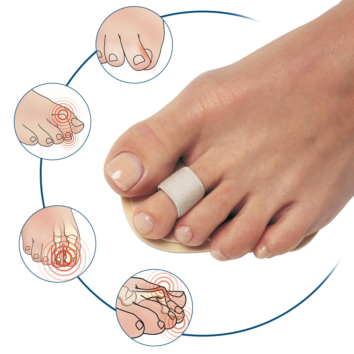 Pedifix - P55 Pedifix Toe Straightener - One Size Fits Most