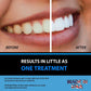 Bright White Smiles - Teeth Whitening Gel Refill Kit - 10 Tubes 44% Carbamide Peroxide Tooth Whitener Formula