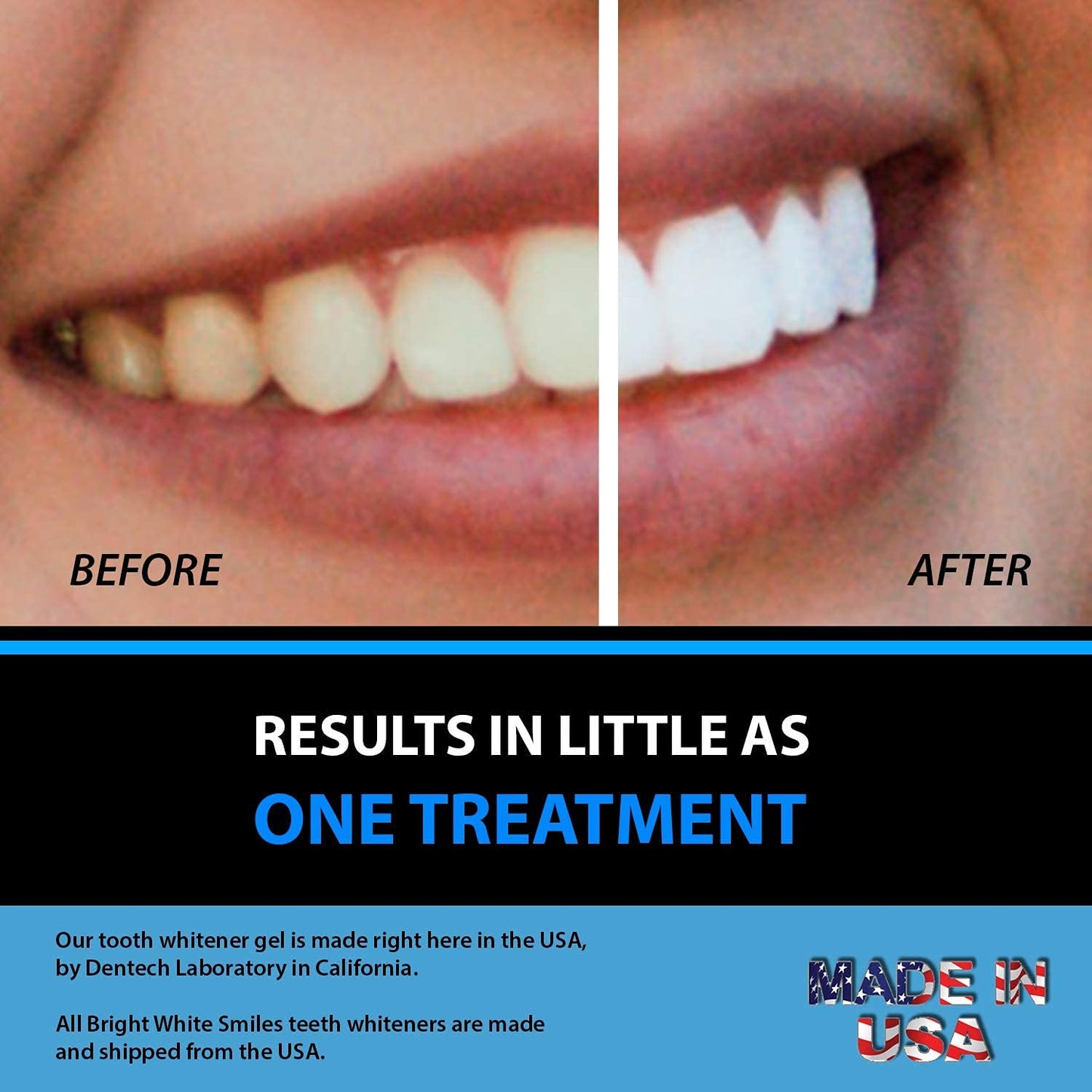 Bright White Smiles - Teeth Whitening Gel Refill Kit - 10 Tubes 44% Carbamide Peroxide Tooth Whitener Formula
