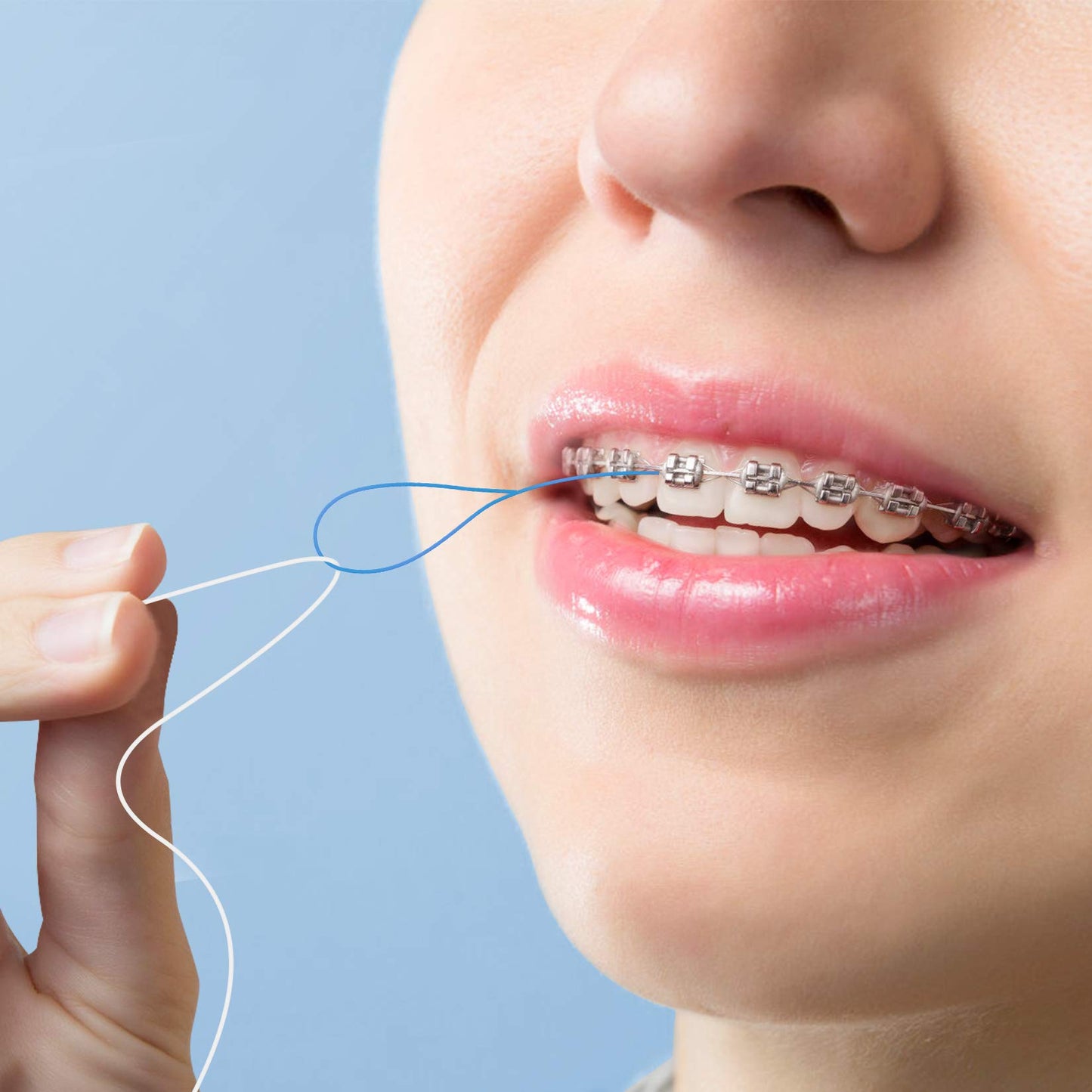 Floss Threaders For Braces, Bridges, And Implants 300 Count (Pack Of 6)