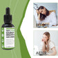 Jteveweu Naturesours 100% Pure Organic Soursop Extract, 100% Pure Organic Soursop Extract, Naturesours Soursop Liquid Drops Herb