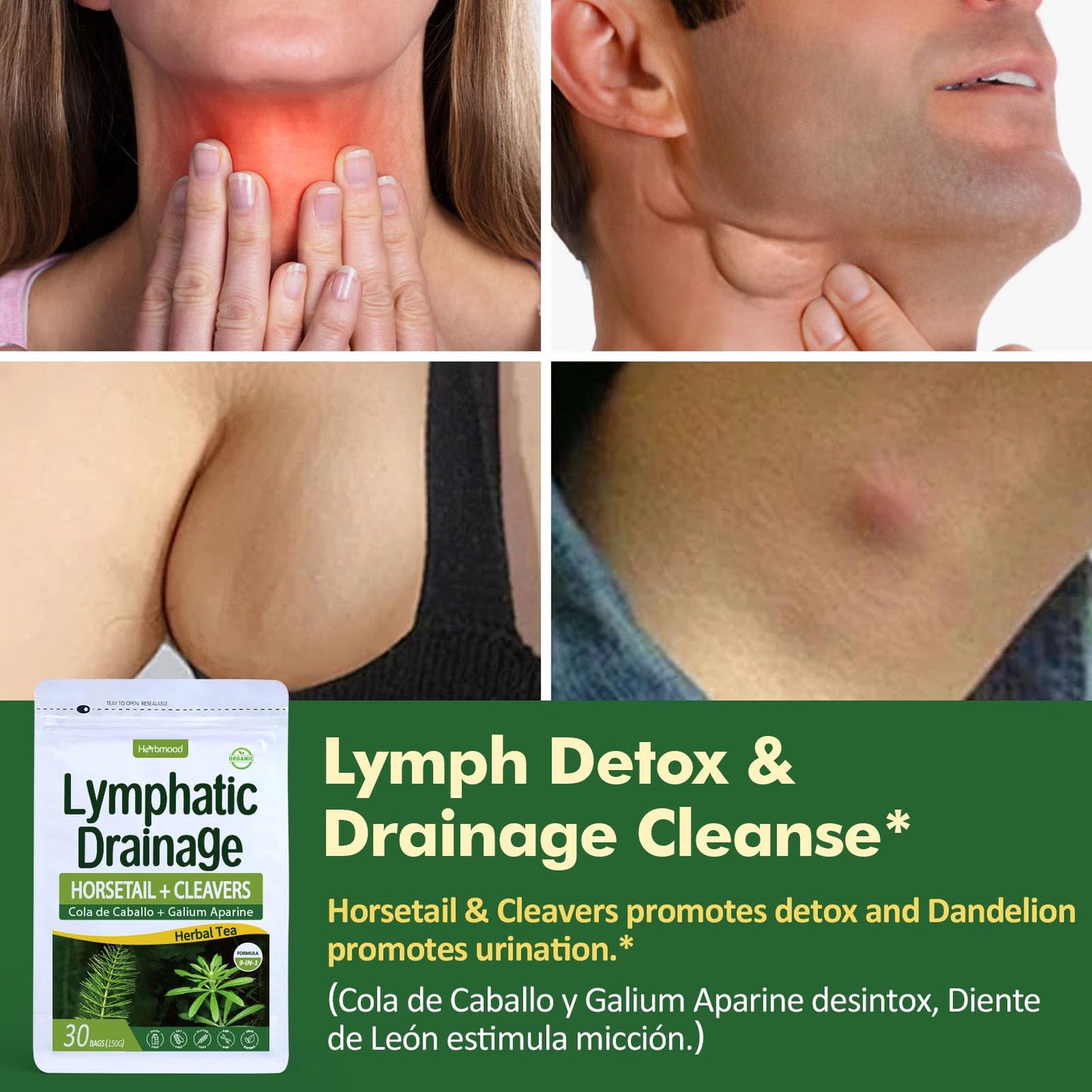 Herbmood Horsetail Lymphatic Drainage Tea Bags for Lymph System Support, Te de Cola de Caballo para Drenaje Linfatico, Cleavers