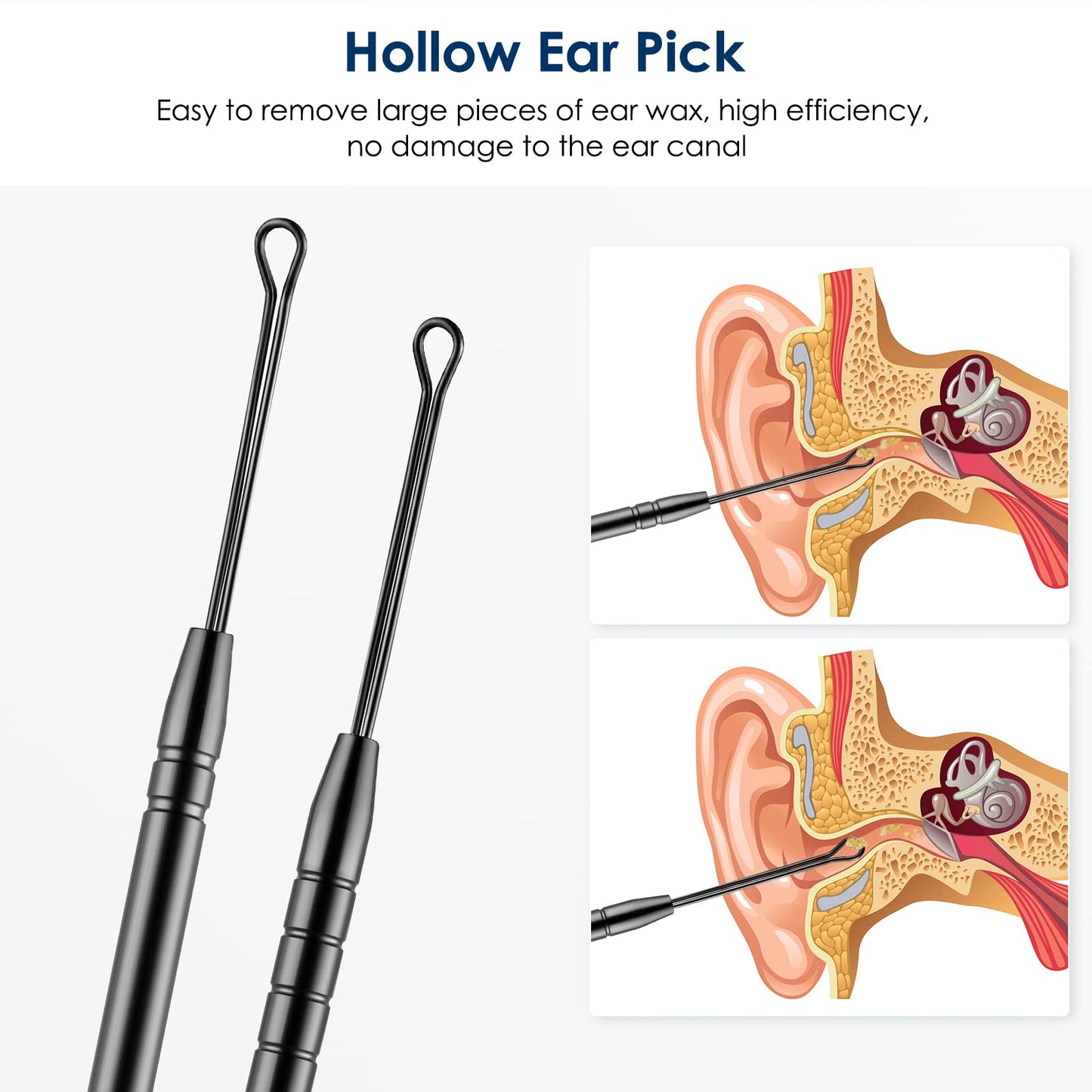 Ear Cleaning Kit,Safe Ear Wax Removal Tool,Earwax Removal Kit,Easy To Use,Painless Ear Pick,With Storage Box And Cleaning Brush