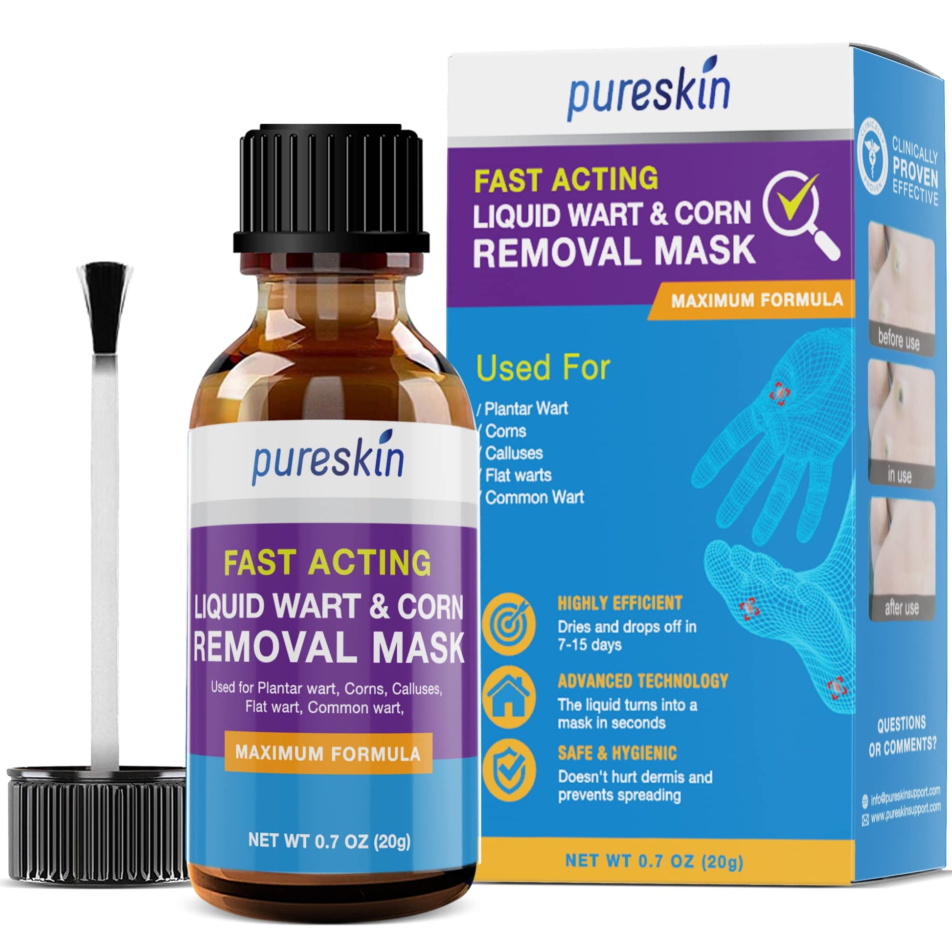 Pureskin Corn Removers For Feet Extra Strength, Foot Corn Remover, Salicylic Acid Corn Wart Removal For Toes, Liquid Corn Treatm