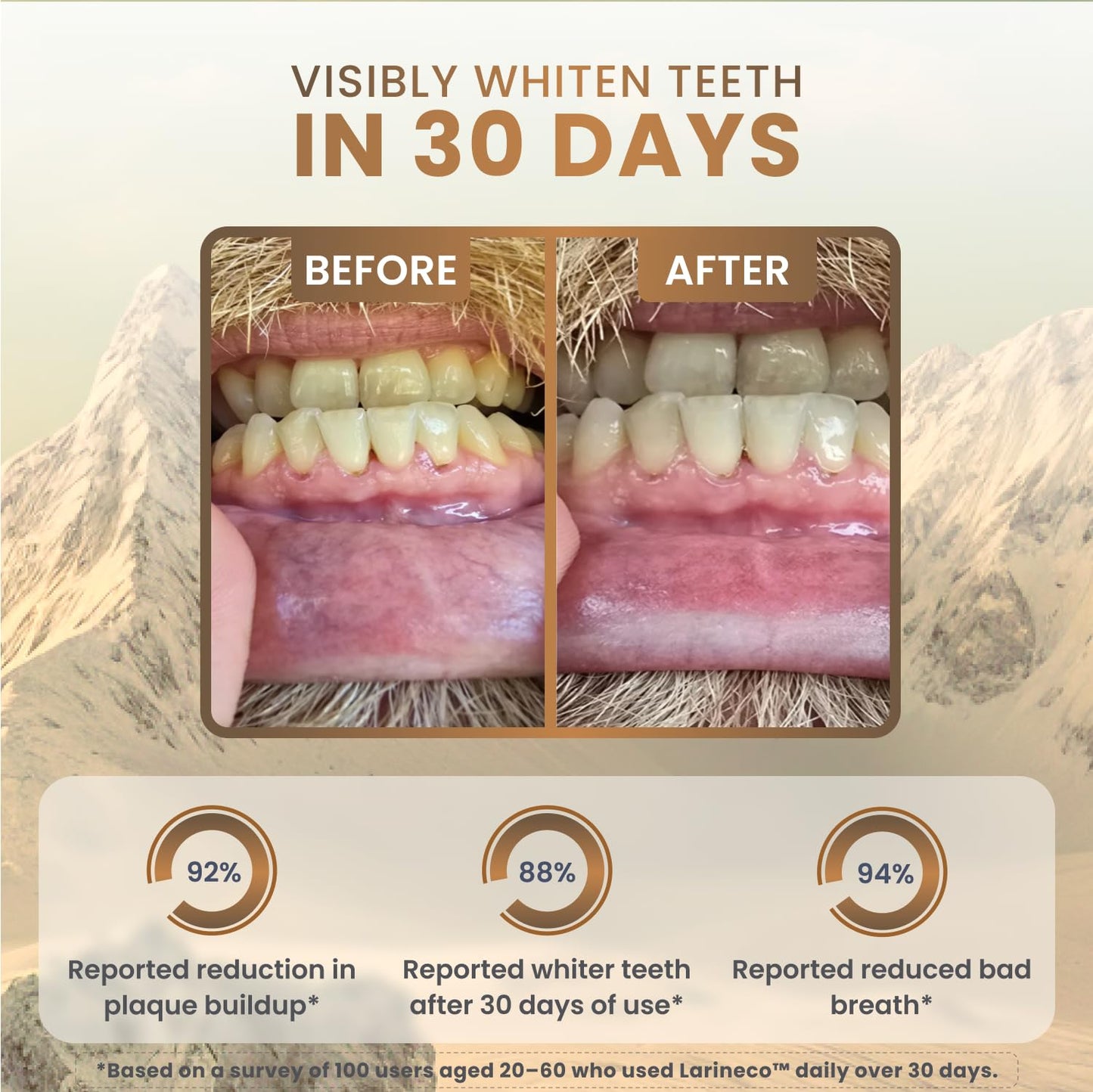 Larineco Remineralizing Gum with Nano Hydroxyapatite & Xylitol - Sugar-Free Cinnamon Xylitol Gum - Plastic-Free, Dye-Free, Aspar