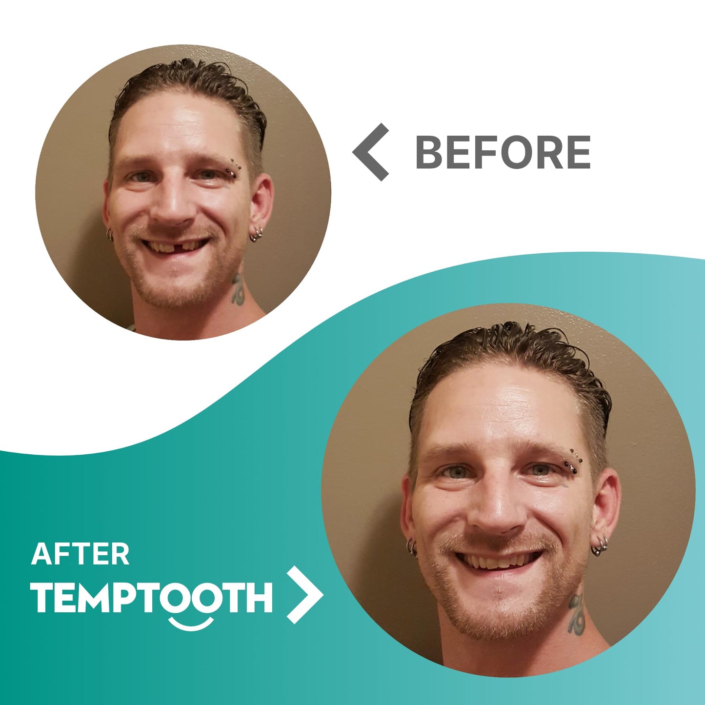Temptooth Tooth Replacement Product With Coloring Material