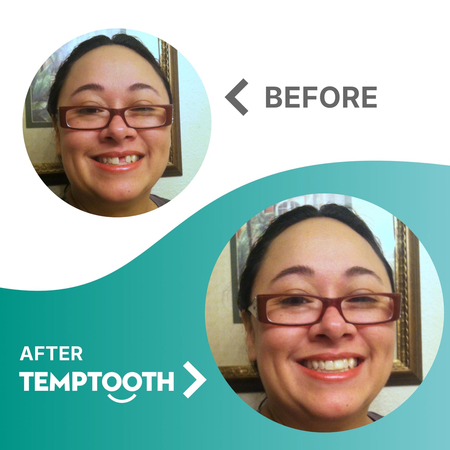 Temptooth Tooth Replacement Product With Coloring Material