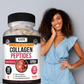 Collagen Peptides