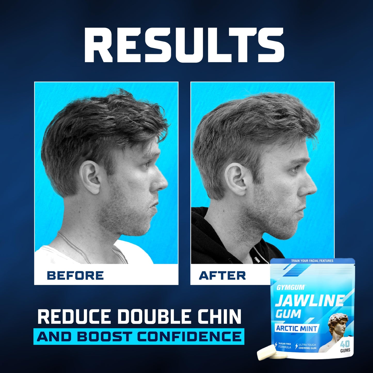 Gymgum Jawline Gum | Hard Chewing Gum For Jaw Strength | Train Your Facial Features - Mewing Jaw Gum | Ultimate Jawline Exercise
