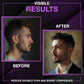 Jawline Chewing Gum For Men | Hard Chewing Gum For Mewing And Stronger Jaw | Tough Gum For Jawline Excercise | Sugar Free With X