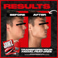Jawz Gum Jawline Chewing Gum, 4 Pack Box, Watermelon, Face Slimming And Toning, Sugar Free