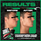 Jawz Gum Jawline Chewing Gum, 4 Pack Box, Mint, Face Slimming And Toning, Sugar Free